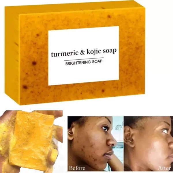 Turmeric Kojic Acid Lemon Soap Bar, for Deep Cleaning and Brightening - Image 8